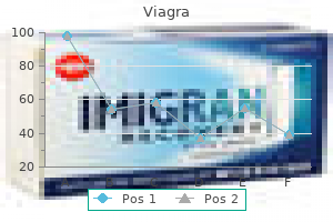 viagra 50mg generic